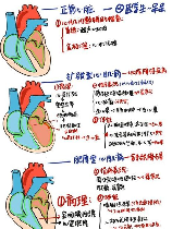 心肌病的三种治疗方法，治疗心肌病有哪些方法？